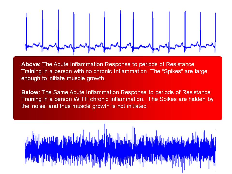 Inflammation Theory of Muscle Growth