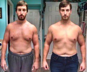 Michael Hepner: Front Before and After Photos